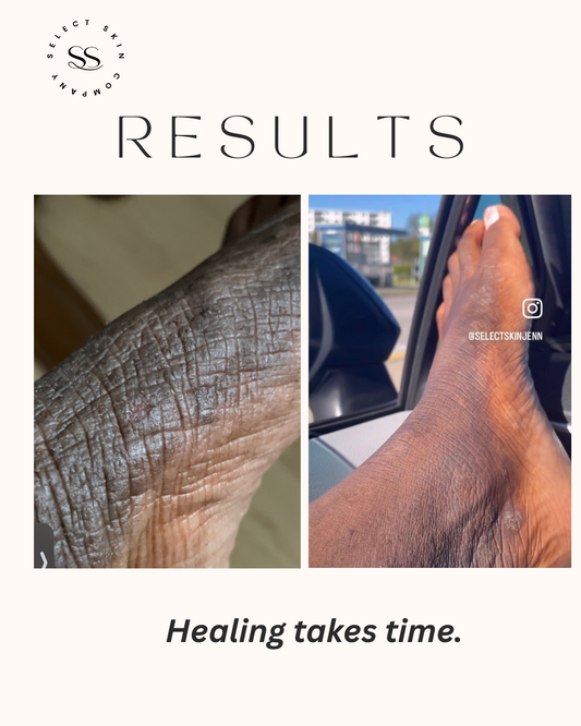 Back to Life Body Butter