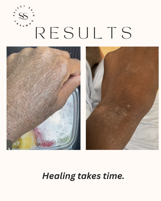 Back to Life Eczema Cream